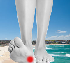 treatment of heal pain bondi